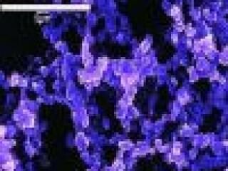 Milliárdos apróság Miskolcra