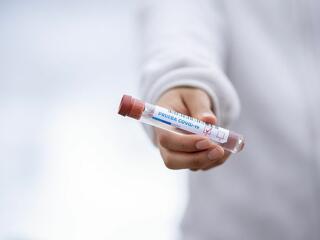 Koronavírus: kijöttek a keddi adatok