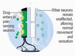 Forradalmi megoldás a fejfájásra