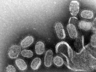 Influenza: csak az oltás jelent megfelelő védelmet!