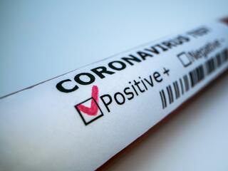 Otthoni koronavírus-tesztek miatt figyelmeztet a GVH