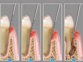 A legtöbb fogatlan ember Európában magyar