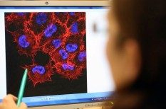 diagnózis, melanoma, mestersége intelligencia, orvosok, rák diagnózis, melanoma, mestersége intelligencia, orvosok, rák