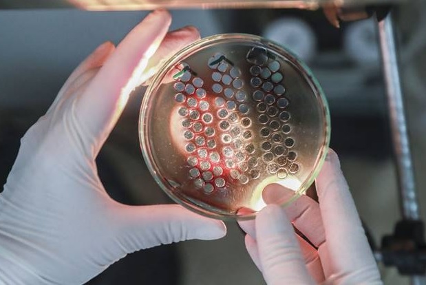 Állati betegségekre tesztelnek vérmintát a Nemzeti Élelmiszerlánc-biztonsági Hivatal laboratóriumában - Fotó: ©FAO/ Isza Ferenc