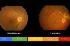 algoritmus, diagnosztika, gyógyászat, kutatás, mesterséges intelligencia algoritmus, diagnosztika, gyógyászat, kutatás, mesterséges intelligencia